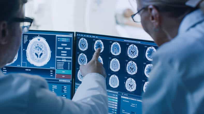 how long to recover from a concussion